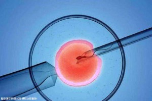 助孕儿子包成功
